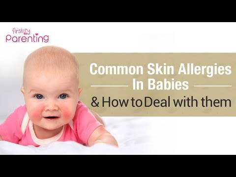 Common Skin Allergies in Babies & How to Treat Them