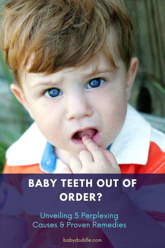 Baby Teeth Out of Order