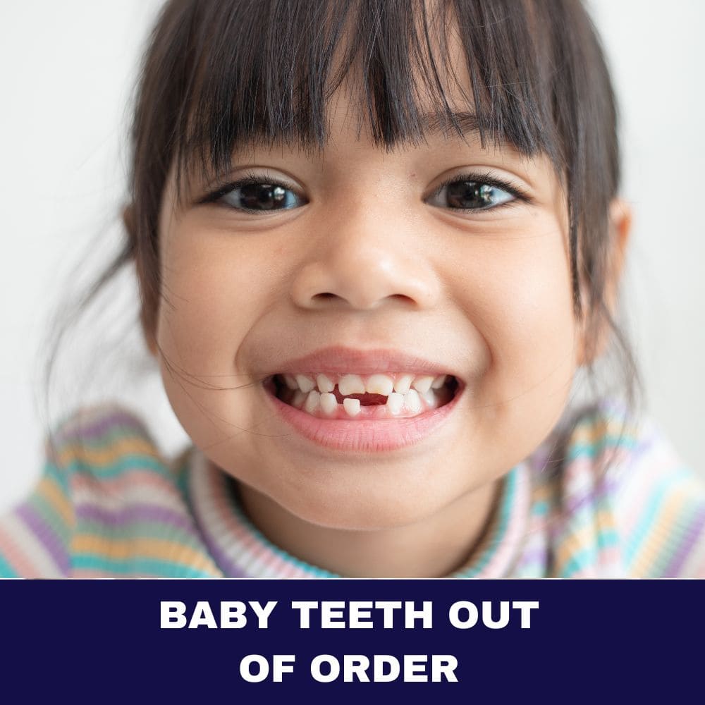 Baby Teeth Out of Order 2